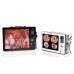 Эндоскопическая камера Qvion HD 3 в 1 Эндоскопическая камера Qvion HD 3 в 1