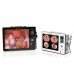 Ендоскопічна камера Qvion HD 3 в 1
