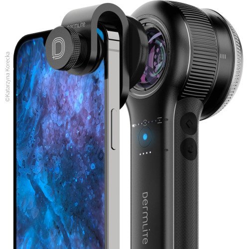 Дерматоскоп DermLite DL5 Plus Дерматоскоп DermLite DL5 Plus
